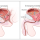 Illustration for article titled Obat Pembesar Penis Vimax